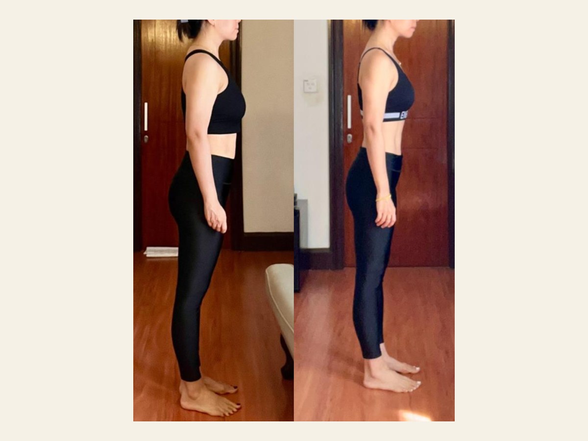 Jennifer before and after photos